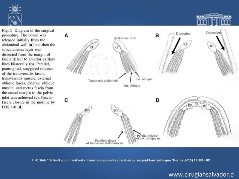 Diapositiva 25 de Separación de Componentes