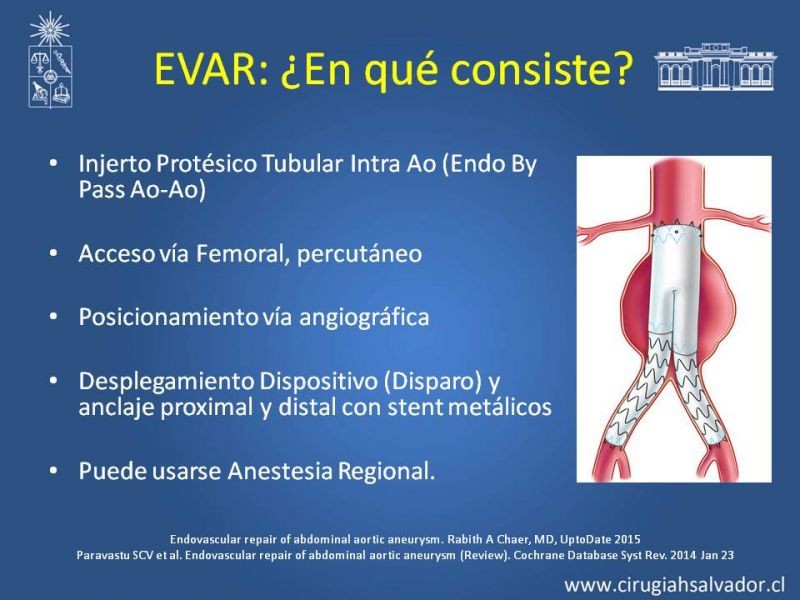 Diapositiva 3 de Endoleak post EVAR