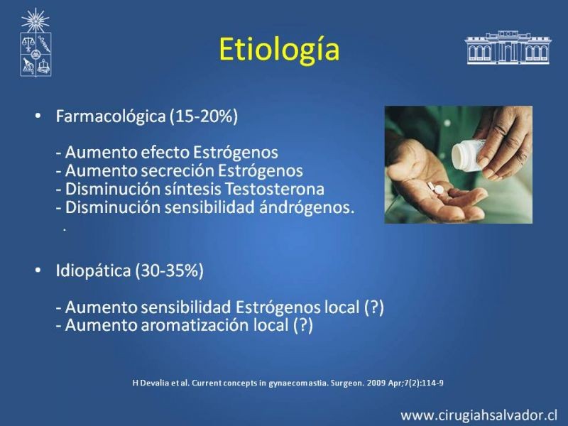 Diapositiva 4 de Ginecomastia