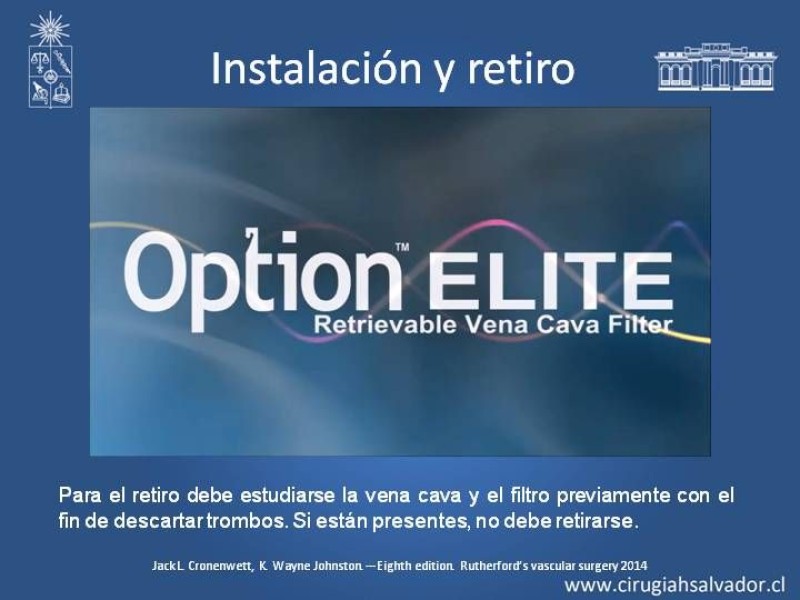 Diapositiva 16 de Filtro de Vena Cava