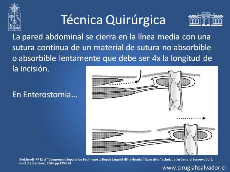 Diapositiva 16 de Separación de Componentes