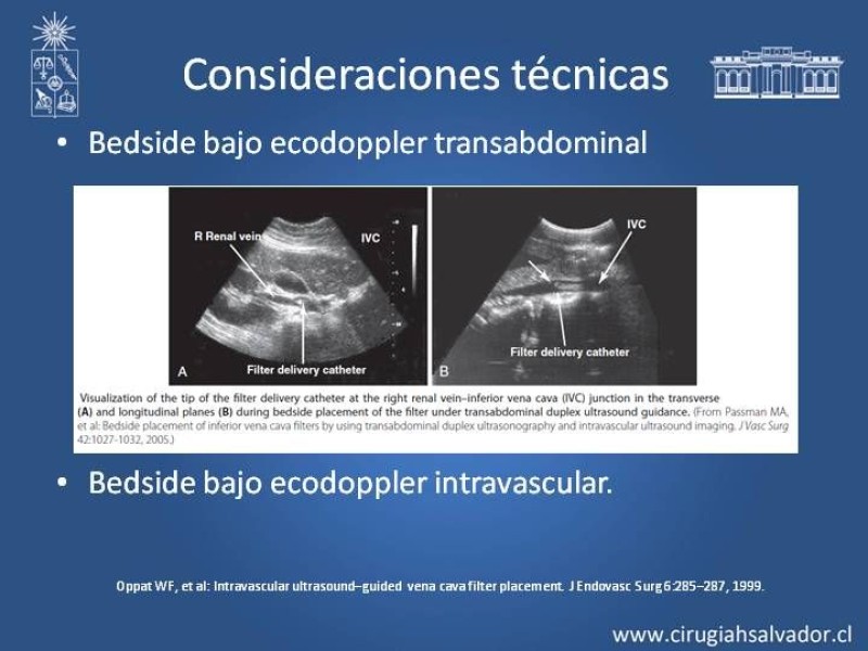 Diapositiva 15 de Filtro de Vena Cava