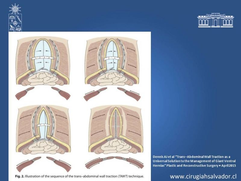 Diapositiva 29 de Separación de Componentes