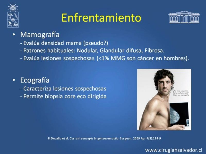 Diapositiva 10 de Ginecomastia