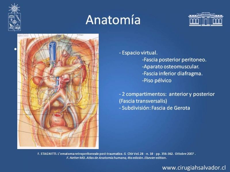 Diapositiva 2 de Hematoma Retroperitoneal Traumático