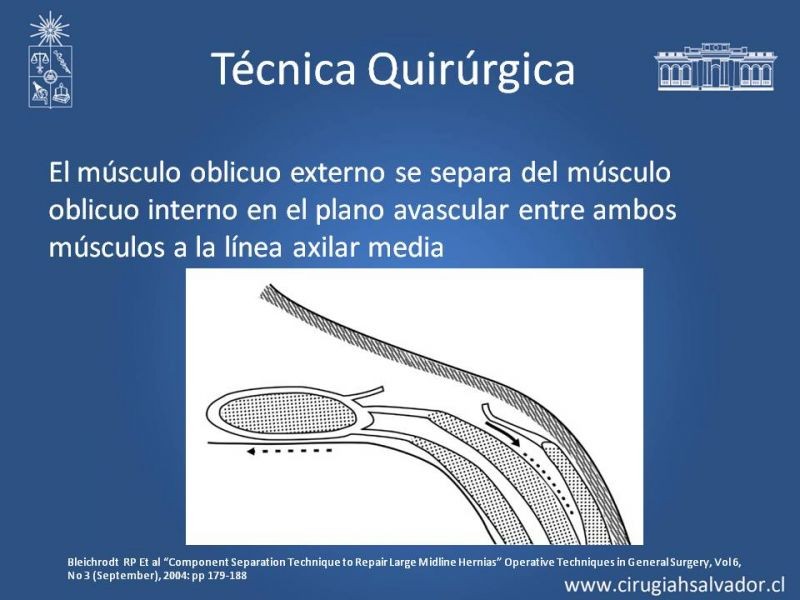 Diapositiva 14 de Separación de Componentes