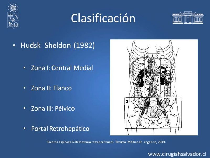 Diapositiva 4 de Hematoma Retroperitoneal Traumático