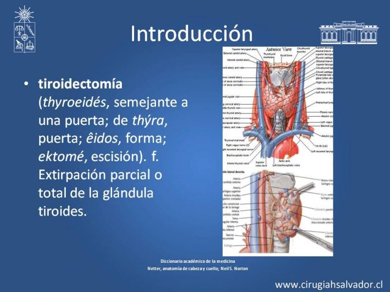 Diapositiva 1 de Hipoparatiroidismo post Tiroidectomía