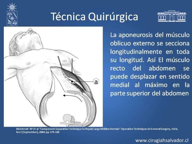 Diapositiva 13 de Separación de Componentes