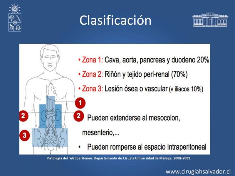 Diapositiva 5 de Hematoma Retroperitoneal Traumático