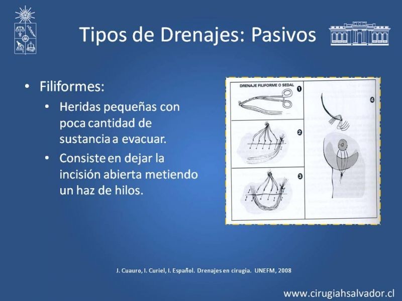 Diapositiva 14 de Drenajes: Indicación y Utilidad