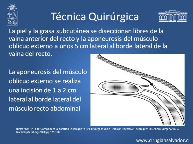 Diapositiva 12 de Separación de Componentes