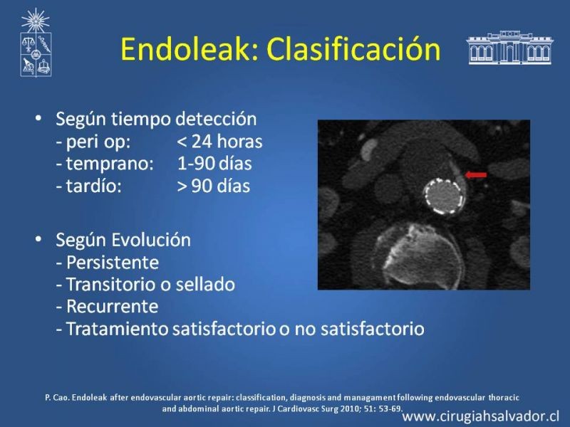 Diapositiva 10 de Endoleak post EVAR