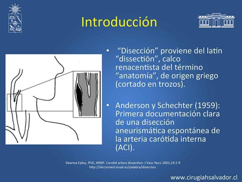 Diapositiva 1 de Disección carotidea