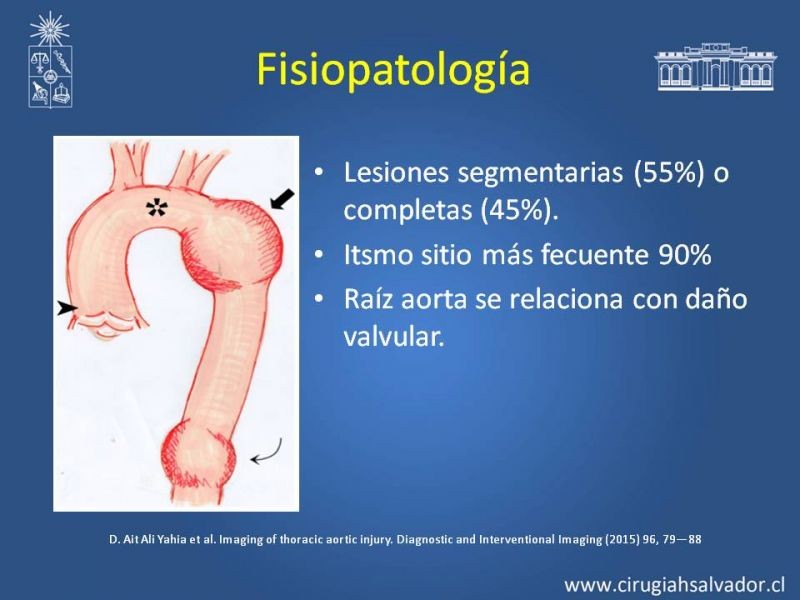 Diapositiva 3 de Trauma de Aorta Torácica