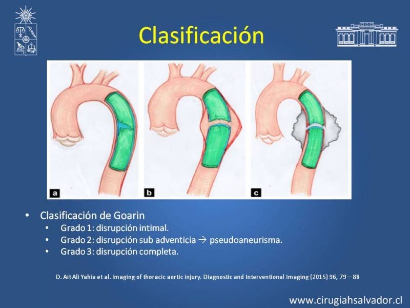 Diapositiva 9 de Trauma de Aorta Torácica