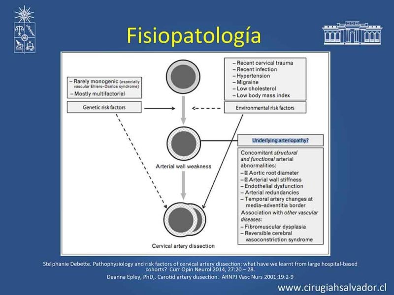 Diapositiva 5 de Disección carotidea