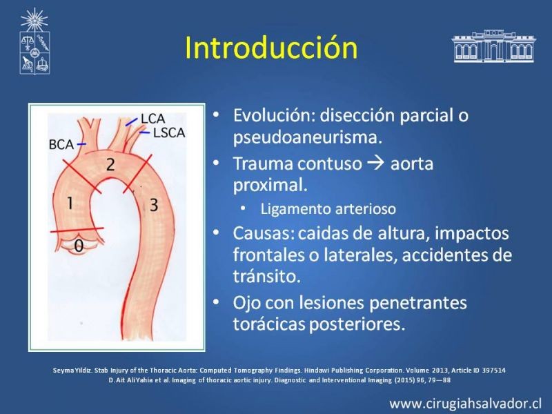 Diapositiva 2 de Trauma de Aorta Torácica