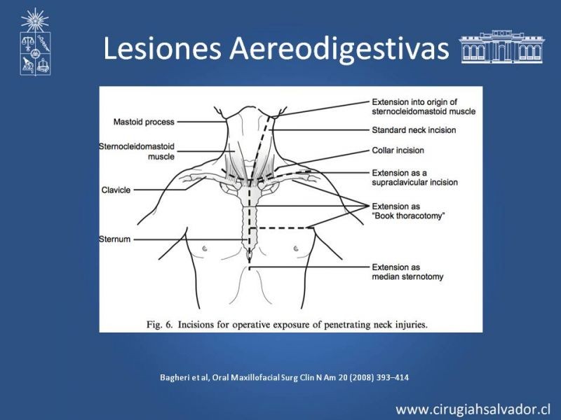 Diapositiva 6 de Trauma Cervical