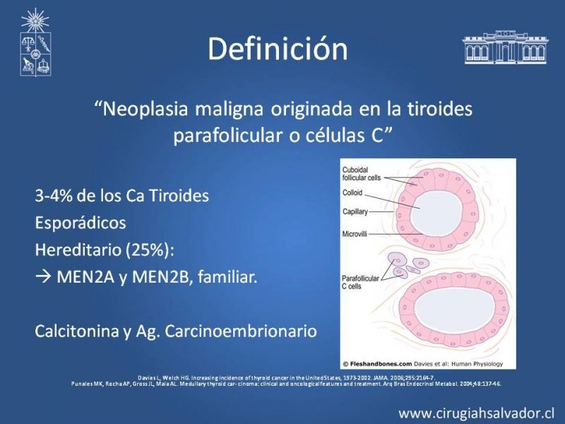 Diapositiva 1 de Cáncer Medular de Tiroides