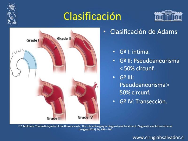 Diapositiva 10 de Trauma de Aorta Torácica