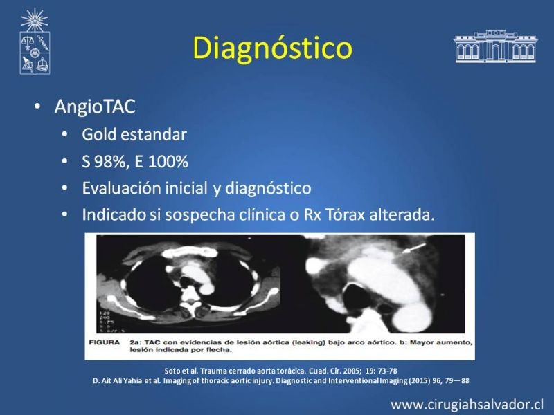 Diapositiva 6 de Trauma de Aorta Torácica