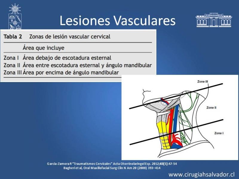 Diapositiva 9 de Trauma Cervical