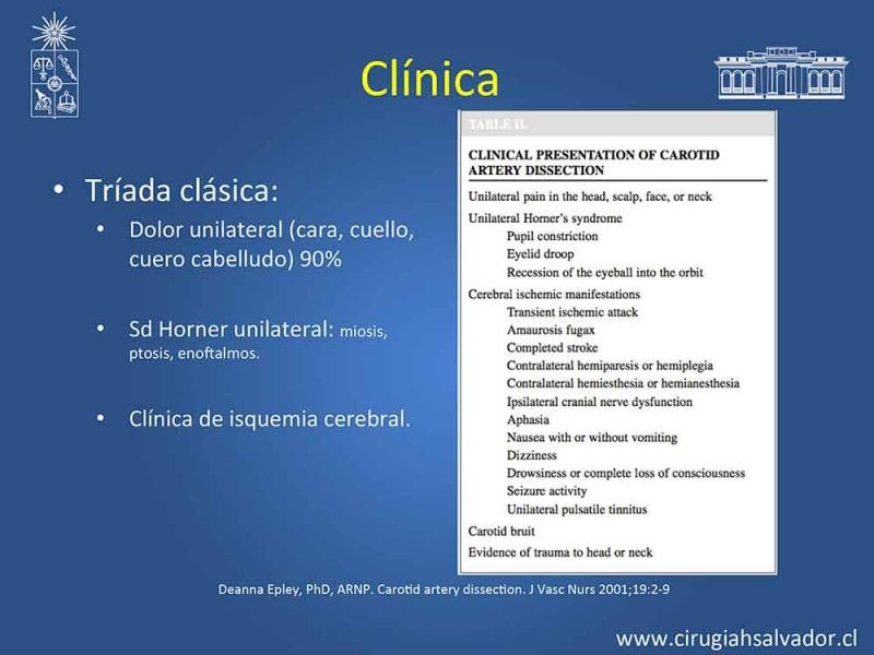 Diapositiva 8 de Disección carotidea