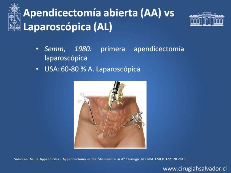 Diapositiva 9 de Novedades en Apendicitis Aguda