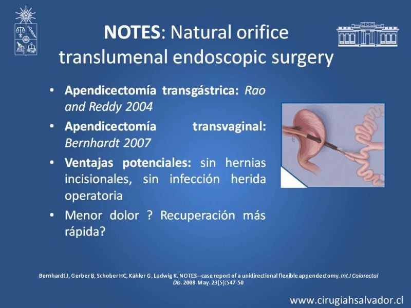 Diapositiva 17 de Novedades en Apendicitis Aguda