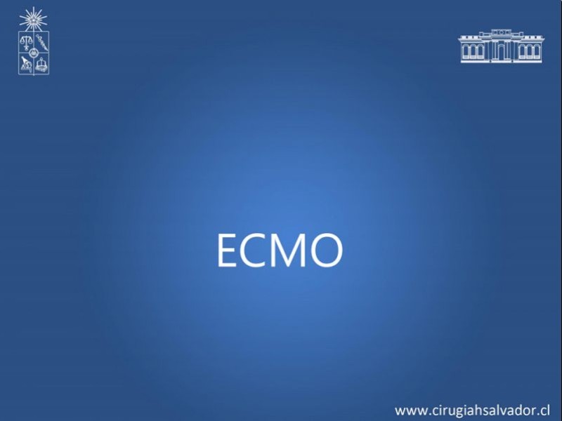 Diapositiva 20 de VAFO v/s ECMO