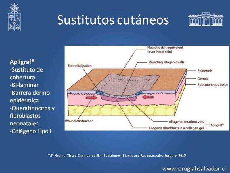 Diapositiva 40 de Injerto dermo-epidérmico: Técnica Quirúrgica 