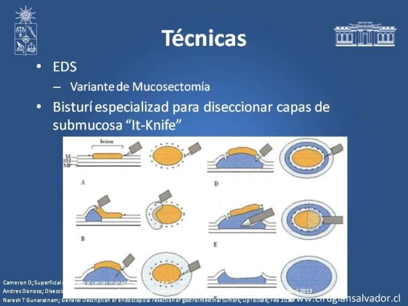 Diapositiva 8 de Resultados Disección Submucosa en esófago y estómago