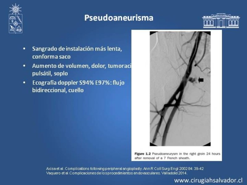 Diapositiva 6 de Complicaciones en Cirugía Endovascular