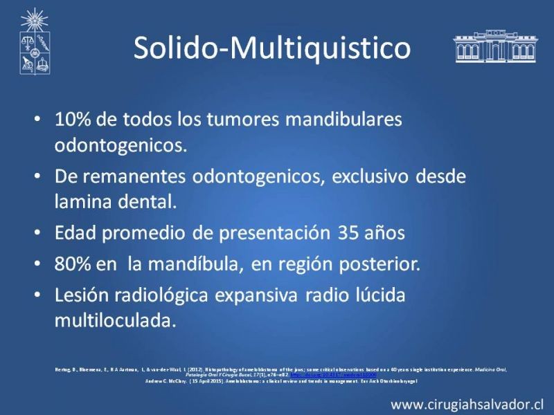 Diapositiva 6 de Ameloblastoma