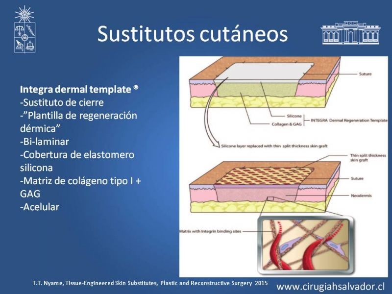 Diapositiva 41 de Injerto dermo-epidérmico: Técnica Quirúrgica 