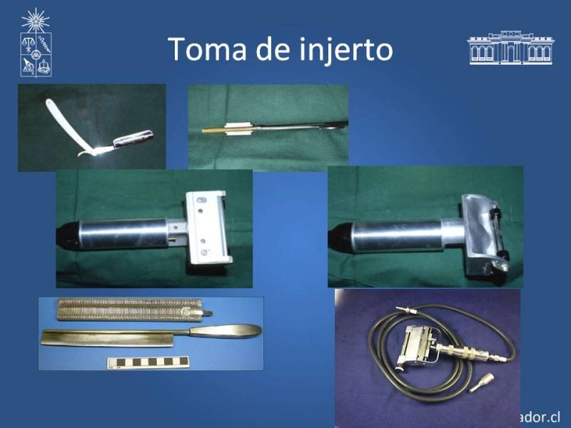 Diapositiva 18 de Injerto dermo-epidérmico: Técnica Quirúrgica 