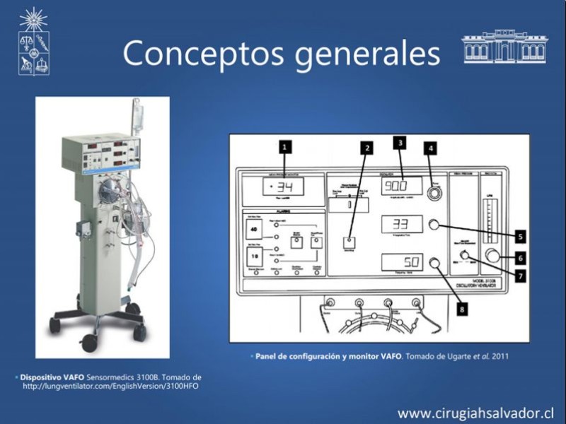 Diapositiva 11 de VAFO v/s ECMO