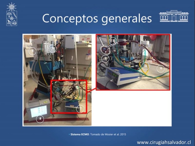 Diapositiva 22 de VAFO v/s ECMO
