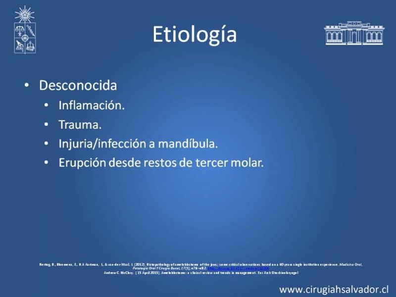Diapositiva 3 de Ameloblastoma