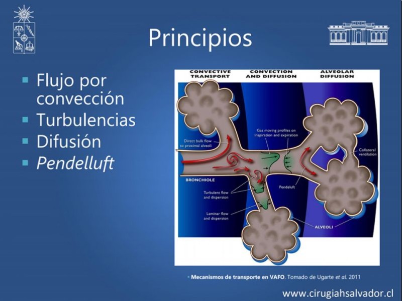 Diapositiva 13 de VAFO v/s ECMO