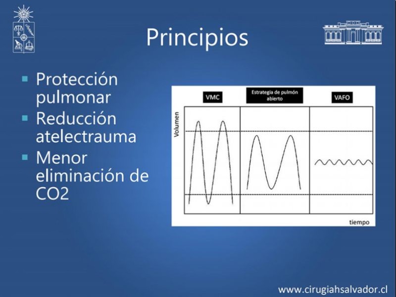 Diapositiva 14 de VAFO v/s ECMO