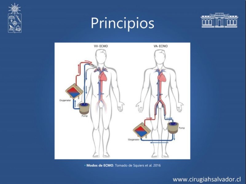 Diapositiva 24 de VAFO v/s ECMO