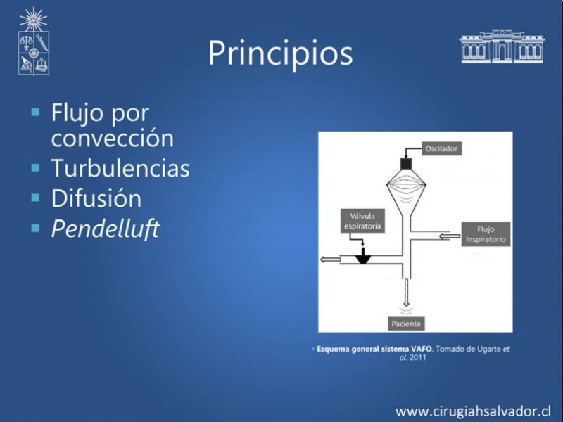 Diapositiva 12 de VAFO v/s ECMO