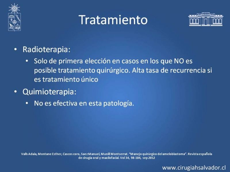 Diapositiva 19 de Ameloblastoma