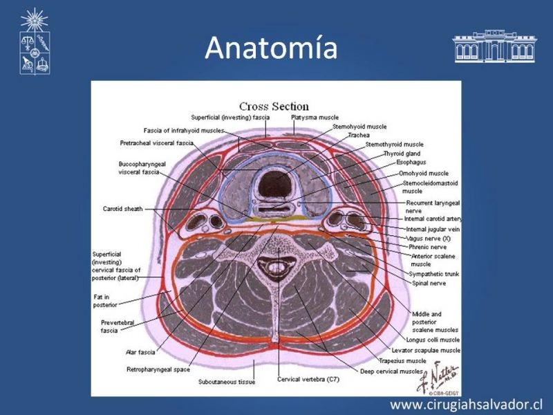 Diapositiva 6 de Trauma Carotídeo