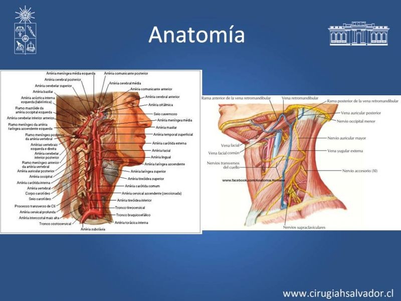 Diapositiva 5 de Trauma Carotídeo