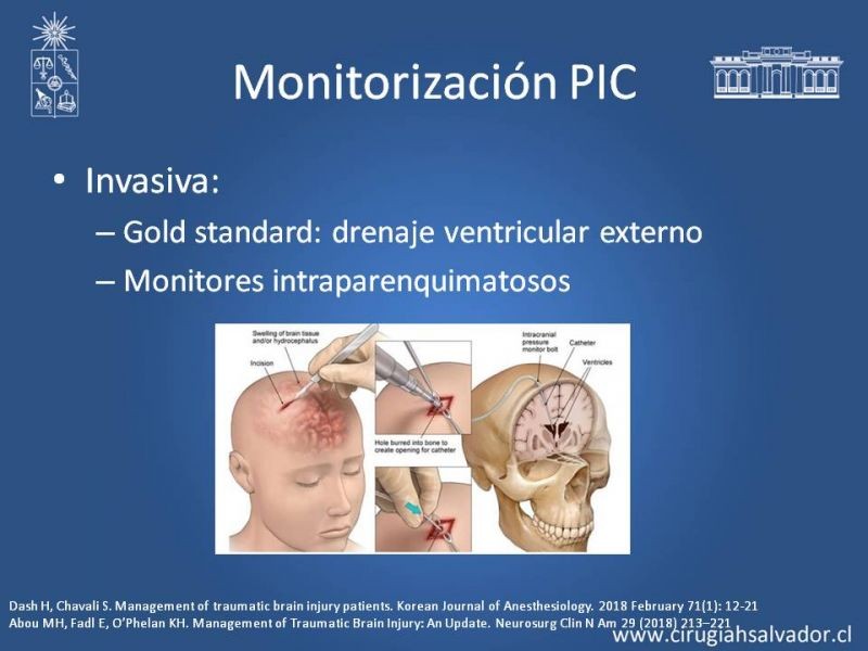 Diapositiva 12 de Trauma encéfalo-craneano grave