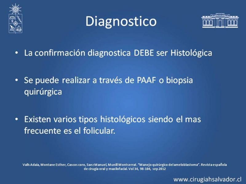 Diapositiva 13 de Ameloblastoma