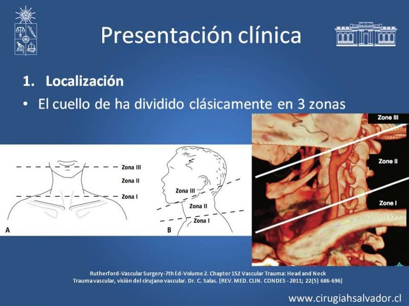Diapositiva 9 de Trauma Carotídeo